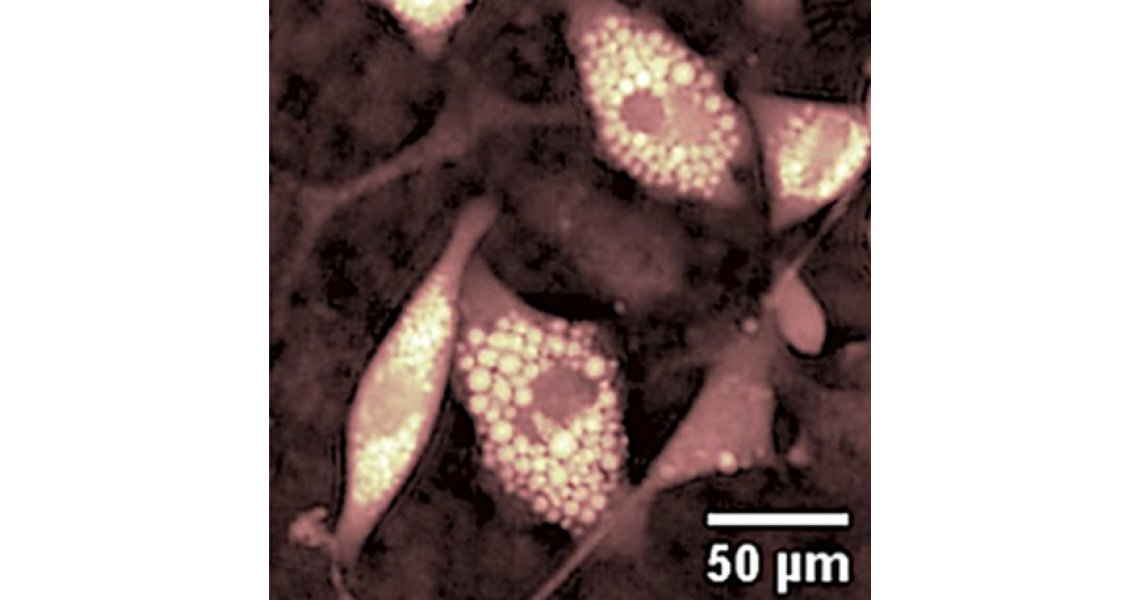 Quantitative phase imaging of biological specimens using DHM