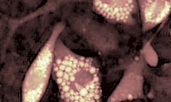 Quantitative phase imaging of biological specimens using DHM