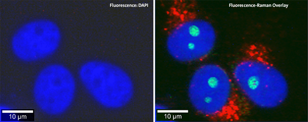 Correlative Raman Fluorescence Microscopy: Fluorescence DAPI Staining & Raman Imaging